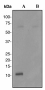 Western blot analysis on fetal heart lysates using anti-Phospholamban Phospho (pS16) antibody (LS-C105664). Cells were either (A) untreated (B) treated with LP.