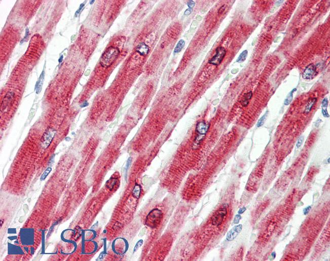 Anti-PLN / Phospholamban antibody IHC of human heart. Immunohistochemistry of formalin-fixed, paraffin-embedded tissue after heat-induced antigen retrieval. Antibody LS-B8337 dilution 3.75 ug/ml.