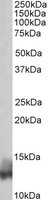 PLN antibody (0.03 ug/ml) staining of Human Heart lysate (35 ug protein/ml in RIPA buffer). Primary incubation was 1 hour. Detected by chemiluminescence.
