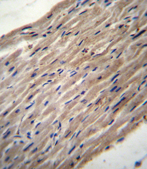 PLOD1 Antibody immunohistochemistry of formalin-fixed and paraffin-embedded human heart tissue followed by peroxidase-conjugated secondary antibody and DAB staining.