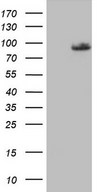 HEK293T cells were transfected with the pCMV6-ENTRY control (Left lane) or pCMV6-ENTRY PLOD2 (Right lane) cDNA for 48 hrs and lysed. Equivalent amounts of cell lysates (5 ug per lane) were separated by SDS-PAGE and immunoblotted with anti-PLOD2.