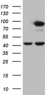 HEK293T cells were transfected with the pCMV6-ENTRY control (Left lane) or pCMV6-ENTRY PLOD2 (Right lane) cDNA for 48 hrs and lysed. Equivalent amounts of cell lysates (5 ug per lane) were separated by SDS-PAGE and immunoblotted with anti-PLOD2.