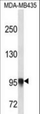 PLOD3 Antibody western blot of MDA-MB435 cell line lysates (35 ug/lane). The PLOD3 antibody detected the PLOD3 protein (arrow).