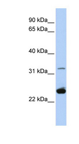 PLP1 antibody LS-C101465 Western blot of HeLa lysate.