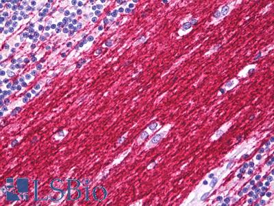 Anti-PLP1 antibody IHC of human brain cerebellum, neuropil. Immunohistochemistry of formalin-fixed, paraffin-embedded tissue after heat-induced antigen retrieval. Antibody LS-B7759 dilution 10 ug/ml.