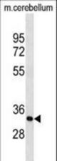RAT PIp1 Antibody western blot of mouse cerebellum tissue lysates (35 ug/lane). The PIp1 antibody detected the PIp1 protein (arrow).