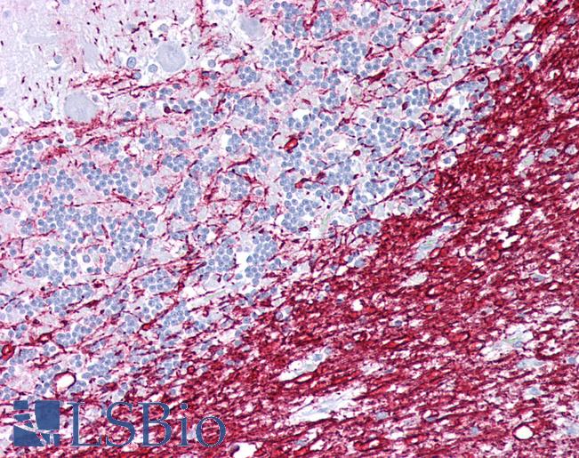 Anti-PLP1 antibody IHC of human brain, cerebellum. Immunohistochemistry of formalin-fixed, paraffin-embedded tissue after heat-induced antigen retrieval. Antibody LS-B6535 concentration 5 ug/ml.