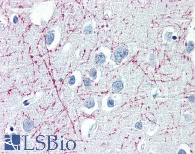 Anti-PLP1 antibody IHC of human brain, cortex. Immunohistochemistry of formalin-fixed, paraffin-embedded tissue after heat-induced antigen retrieval. Antibody LS-B2867 concentration 10 ug/ml.