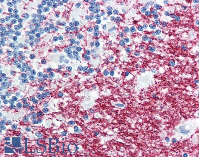 Anti-PLP1 antibody IHC of human brain, cerebellum. Immunohistochemistry of formalin-fixed, paraffin-embedded tissue after heat-induced antigen retrieval. Antibody LS-B2867 concentration 10 ug/ml.