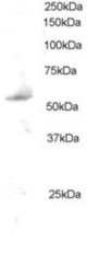 Antibody staining (0.5 ug/ml) of Mouse Kidney extract (RIPA buffer, 35 ug total protein per lane). Primary incubated for 1 hour. Detected by Western blot of chemiluminescence.