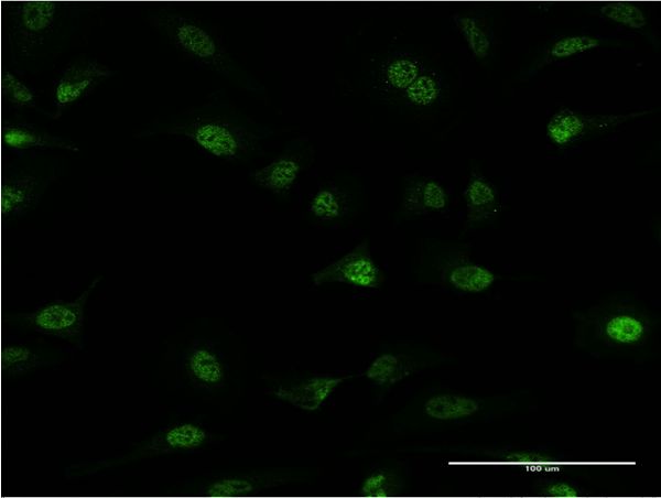 Immunofluorescence of monoclonal antibody to PLRG1 on HeLa cell . [antibody concentration 10 ug/ml]
