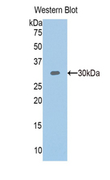 Western blot of recombinant PLS3 / T Plastin.