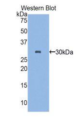 Western blot of recombinant PLS3 / T Plastin.