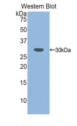 Western blot of recombinant PLS3 / T Plastin.