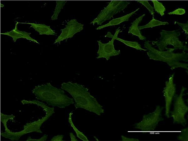 Immunofluorescence of monoclonal antibody to PLS3 on HeLa cell . [antibody concentration 10 ug/ml]