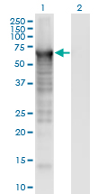Western Blot analysis of PLS3 expression in transfected 293T cell line by PLS3 monoclonal antibody (M01), clone 5B9.Lane 1: PLS3 transfected lysate (Predicted MW: 70.8 KDa).Lane 2: Non-transfected lysate.