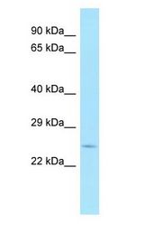 PLSCR2 antibody Western Blot of Fetal Heart.