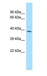 PLSCR4 antibody Western Blot of Fetal Lung.