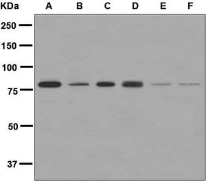 Western blot analysis on (A) JAR, (B) HepG2, (C) HeLa, (D) BxPC-3, (E) fetal brain, and (F) fetal lung lysates using anti-PLTP antibody.