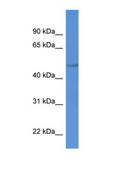 PLTP antibody LS-B8259 Western blot of MCF7 Cell lysate. Antibody concentration 1 ug/ml.