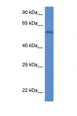PLXDC2 antibody LS-C145225 Western blot of Mouse Pancreas lysate. Antibody concentration 1 ug/ml.