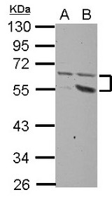 Sample (30 ug of whole cell lysate) A: HeLa B: HepG2 10% SDS PAGE PLXDC2 antibody diluted at 1:1000