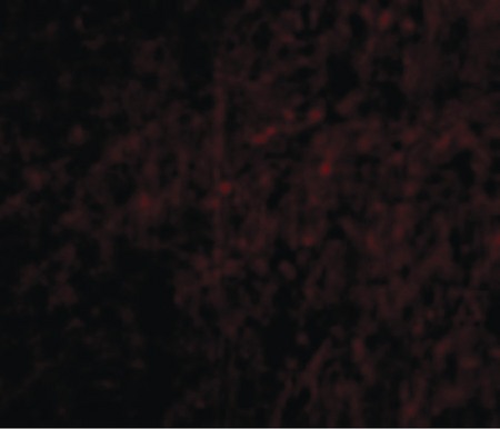Immunofluorescence of Plxdc2 in Human Brain cells with Plxdc2 antibody at 20 ug/ml.