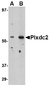 Western blot of Plxdc2 in human brain tissue lysate with Plxdc2 antibody at (A) 0.5 (B) 1 ug/ml.