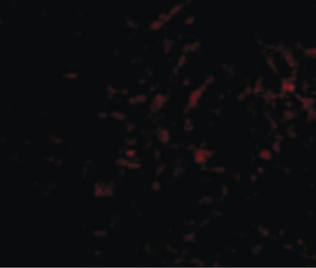 Immunofluorescence of Plxdc2 in Human Brain cells with Plxdc2 antibody at 50 ug/ml.