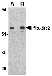 Western blot of Plxdc2 in human colon tissue lysate with Plxdc2 antibody at (A) 0.5 (B) 1 ug/ml.