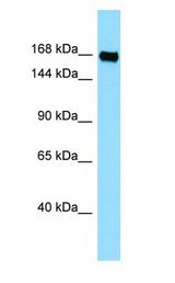 PLXNB3 / Plexin B3 antibody Western Blot of Jurkat.
