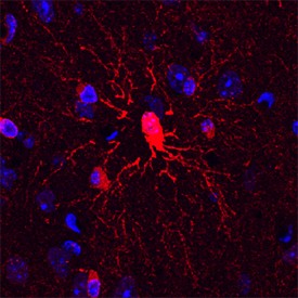 Plexin B3 in Mouse Brain. Plexin B3 was detected in perfusion fixed frozen sections of mouse brain using Sheep Anti-Mouse/Rat Plexin B3 Antigen AffinitypurifiedPolyclonalAntibody at 1.7 ug/ml overnight at 4 °C. Tissue was stained using the NorthernLights 557conjugatedAntiSheepIgG Secondary Antibody (red) and counterstained with DAPI (blue). Specific staining was localized to oligodendrocytes.