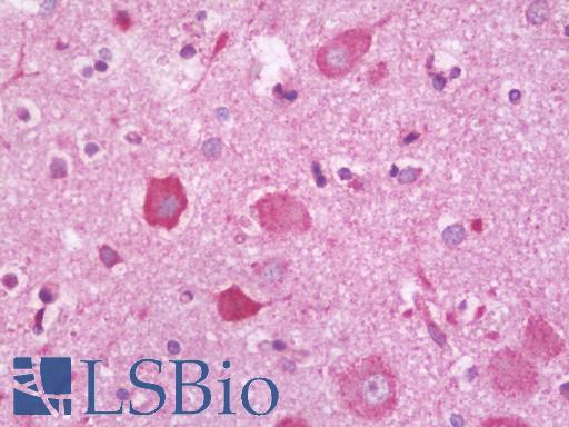 Anti-PLXNC1 / Plexin C1 antibody IHC staining of human brain, cortex. Immunohistochemistry of formalin-fixed, paraffin-embedded tissue after heat-induced antigen retrieval. Antibody LS-B10991 dilution 1:100.