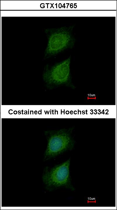 Immunofluorescence of methanol-fixed HeLa using Plexin D1 antibody at 1:500 dilution.