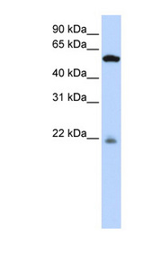 PM20D2 antibody LS-C102403 Western blot of 721_B cell lysate.