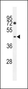 PM20D2 Antibody western blot of K562 cell line lysates (35 ug/lane). The PM20D2 antibody detected the PM20D2 protein (arrow).