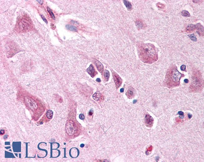 Anti-NOXA antibody IHC of human brain, cortex. Immunohistochemistry of formalin-fixed, paraffin-embedded tissue after heat-induced antigen retrieval. Antibody LS-B121 concentration 10 ug/ml.