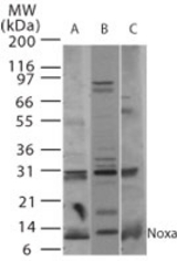 Western blot of Noxa in A) human, B) mouse, and C) rat thymus tissue using antibody at 2 ug/ml.