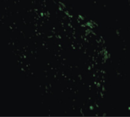 Immunofluorescence of Noxa in Human Stomach cells with Noxa antibody at 10 ug/ml.