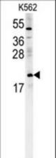 PMCH Antibody western blot of K562 cell line lysates (15 ug/lane). The PMCH antibody detected the PMCH protein (arrow).