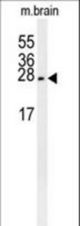 PMCH Antibody western blot of mouse brain tissue lysates (15 ug/lane). The PMCH antibody detected the PMCH protein (arrow).