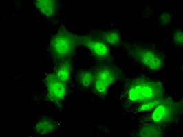 Anti-PPME1 mouse monoclonal antibody immunofluorescent staining of COS7 cells transiently transfected by pCMV6-ENTRY PPME1.