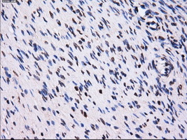 IHC of paraffin-embedded Ovary tissue using anti-PPME1 mouse monoclonal antibody. (Dilution 1:50).