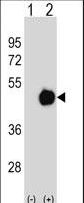 Western blot of PPME1 (arrow) using rabbit polyclonal PPME1 Antibody. 293 cell lysates (2 ug/lane) either nontransfected (Lane 1) or transiently transfected (Lane 2) with the PPME1 gene.