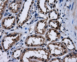 IHC of paraffin-embedded Kidney tissue using anti-PPME1 mouse monoclonal antibody. (Dilution 1:50).