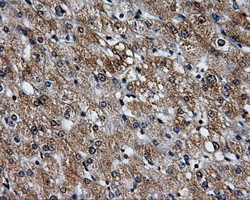IHC of paraffin-embedded liver tissue using anti-PPME1 mouse monoclonal antibody. (Dilution 1:50).