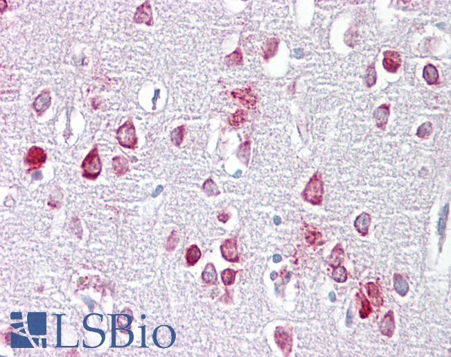 Anti-PPME1 antibody IHC of human brain, cortex. Immunohistochemistry of formalin-fixed, paraffin-embedded tissue after heat-induced antigen retrieval. Antibody LS-B6636 concentration 5 ug/ml.