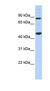 PPME1 antibody LS-B6636 Western blot of 721_B cell lysate.
