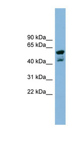 PPME1 antibody LS-C107980 Western blot of NCI-H226 cell lysate.