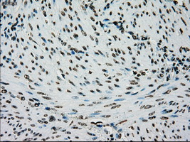 IHC of paraffin-embedded endometrium tissue using anti-SILV mouse monoclonal antibody. (Dilution 1:50).